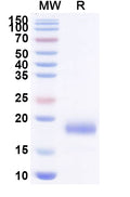 SDS-PAGE for Anti-SARS-CoV-2 S Protein Nanobody (SAA1103)