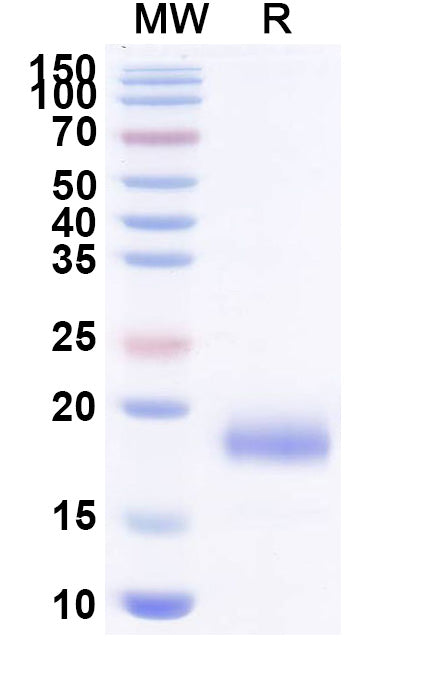 SDS-PAGE for Anti-SARS-CoV-2 S Protein Nanobody (SAA1103)