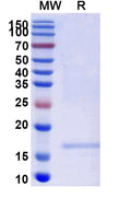 SDS-PAGE for Anti-SARS-CoV-2 S Protein Nanobody (SAA1105)