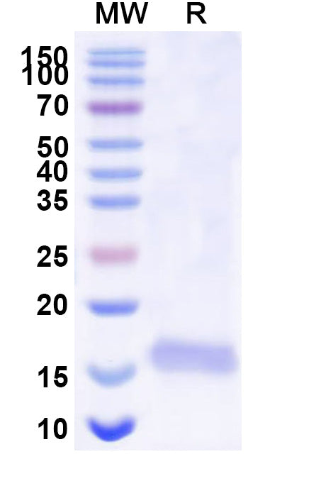 SDS-PAGE for Anti-SARS-CoV-2 S Protein Nanobody (SAA1108)