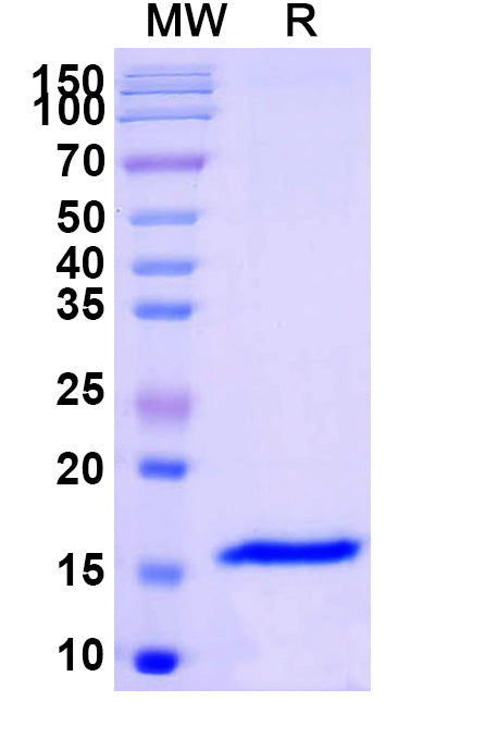 SDS-PAGE for Anti-SARS-CoV-2 S Protein Nanobody (SAA1109)
