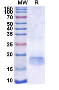 SDS-PAGE for Anti-SARS-CoV-2 S Protein Nanobody (SAA1110)