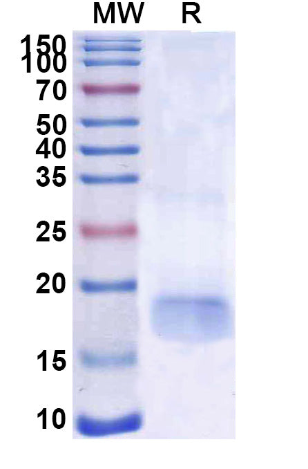 SDS-PAGE for Anti-SARS-CoV-2 S Protein Nanobody (SAA1110)