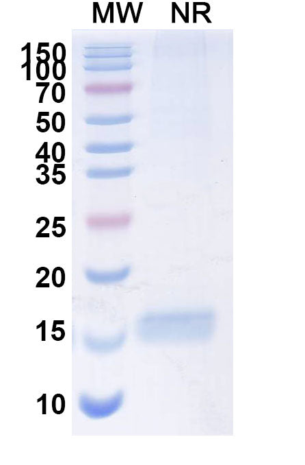 SDS-PAGE for Anti-SARS-CoV-2 S Protein Nanobody (SAA1111)