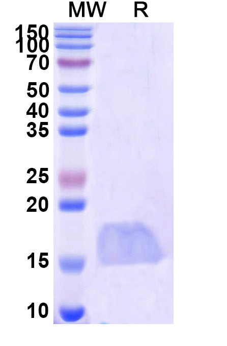 SDS-PAGE for Anti-SARS-CoV-2 S Protein Nanobody (SAA1114)