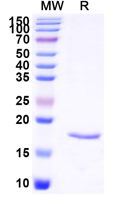 SDS-PAGE for Anti-SARS-CoV-2 S Protein Nanobody (SAA1123)