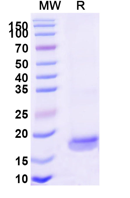 SDS-PAGE for Anti-SARS-CoV-2 S Protein Nanobody (SAA1124)