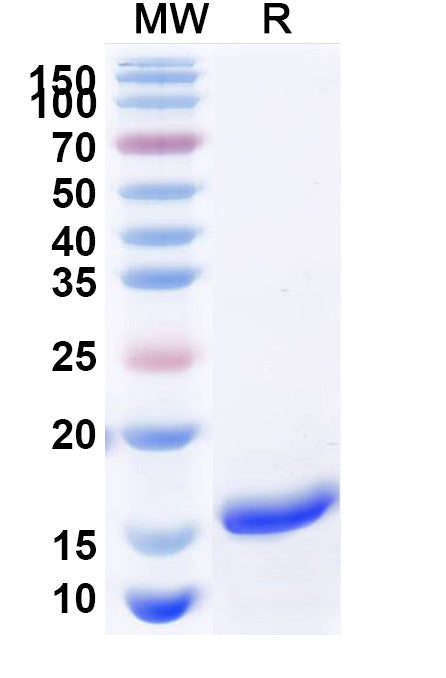 SDS-PAGE for Anti-SARS-CoV-2 S Protein Nanobody (SAA1147)
