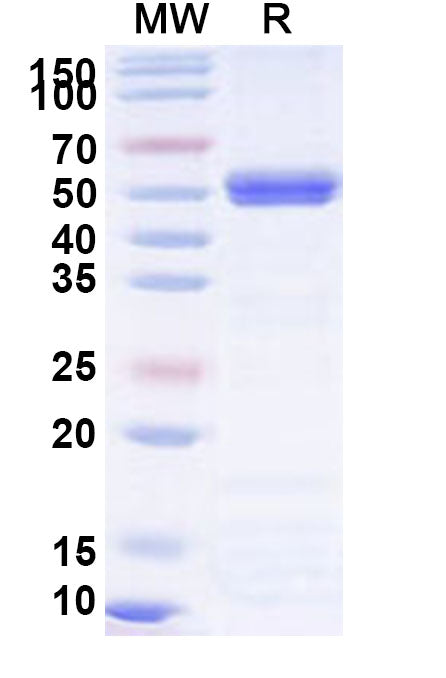 Recombinant BCCV N/Nucleoprotein Protein, N-His
