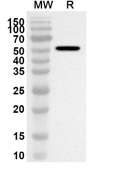 Western blot analysis was performed using anti-BCCV N/Nucleoprotein polyclonal antibody at 1ug/mL on recombinant BCCV N/Nucleoprotein (Catalog No. VK484012).