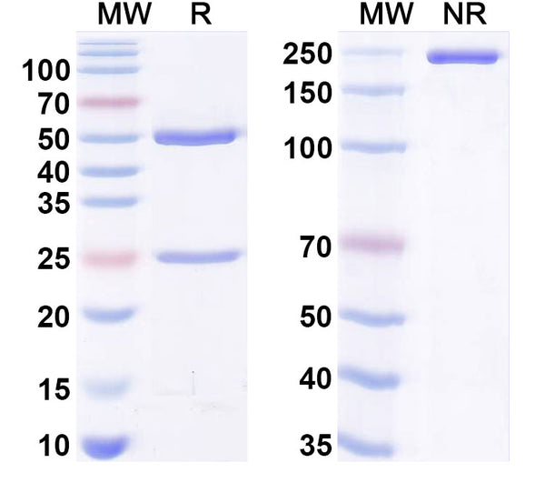 SDS-PAGE for Anti-EBV/HHV-4 LMP1/BNLF1 Antibody (A3H5)