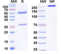 SDS-PAGE for Anti-EBV/HHV-4 LMP1/BNLF1 Antibody (B10B7)