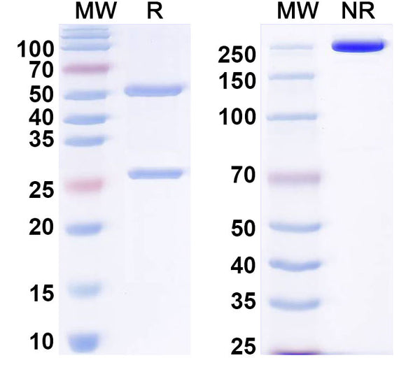 SDS-PAGE for Anti-EBV/HHV-4 LMP1/BNLF1 Antibody (G5)