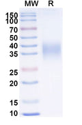 Recombinant EBV/HHV4 GP42/Glycoprotein 42 Protein, C-His