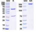 SDS-PAGE for Anti-HIV-1 Matrix protein p17/MA protein Antibody (M33)