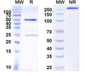 SDS-PAGE for Anti-HIV-1 Capsid protein p24/CA protein Antibody (A3).