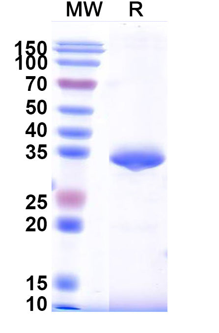 Recombinant DENV-3 Protein prM/prM Protein, N-GST & C-His