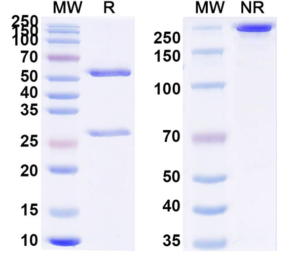 SDS-PAGE for Anti-Influenza A virus Neuraminidase/NA protein Antibody (NC41)