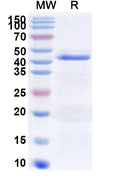 Recombinant Influenza A virus (H17N10) NA/Neuraminidase Protein, N-His