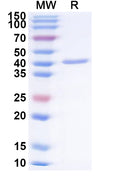 Recombinant Influenza A virus (H18N11) NA/Neuraminidase Protein, N-His