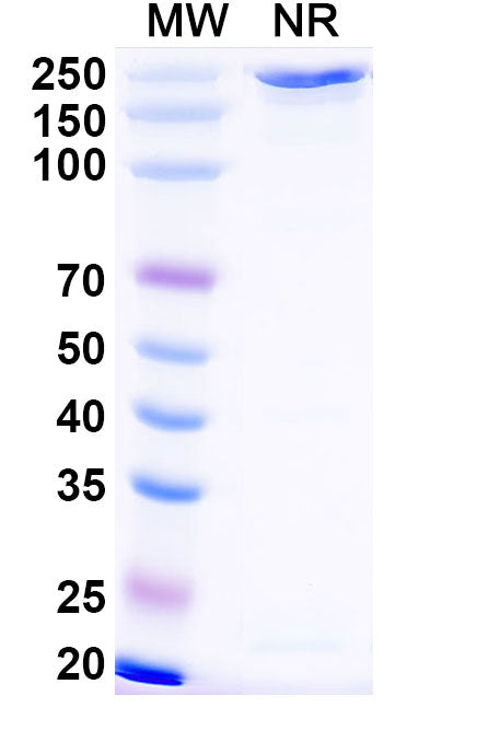 SDS-PAGE for Anti-Influenza A virus Neuraminidase/NA Antibody (NA-63).