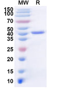 Recombinant Influenza A virus (H1N1) NA/Neuraminidase Protein, N-His