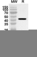 Western blot analysis was performed using anti-Influenza A virus (H1N1) NA/Neuraminidase polyclonal antibody at 1ug/mL on recombinant Influenza A virus (H1N1) NA/Neuraminidase (Catalog No. VK496062).