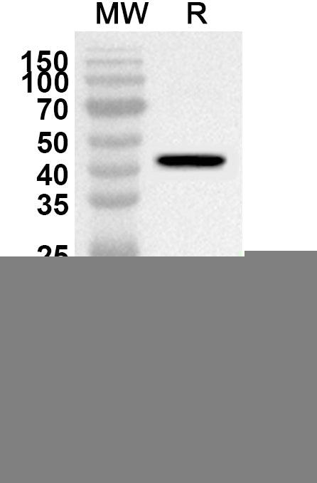 Western blot analysis was performed using anti-Influenza A virus (H1N1) NA/Neuraminidase polyclonal antibody at 1ug/mL on recombinant Influenza A virus (H1N1) NA/Neuraminidase (Catalog No. VK496062).