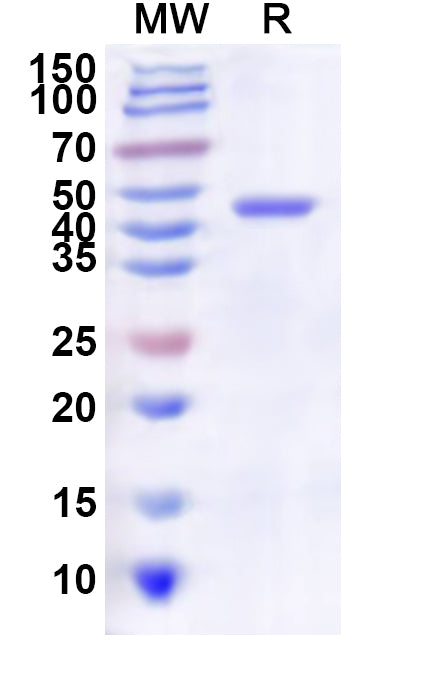 Recombinant Influenza A virus (H3N2) NA/Neuraminidase Protein, N-His