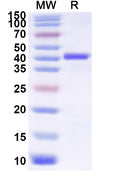 Recombinant Influenza A virus (H3N8) NA/Neuraminidase Protein, N-His