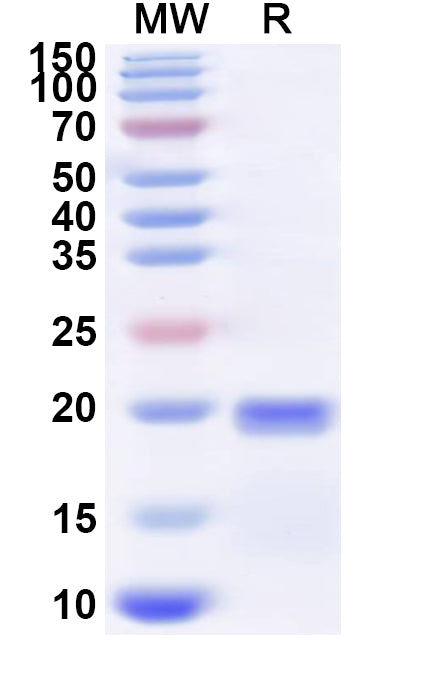 Recombinant Influenza A virus (H5N6) NA/Neuraminidase Protein, N-His