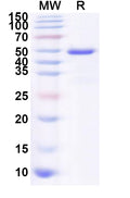 Recombinant Influenza A virus (H7N3) NA/Neuraminidase Protein, N-His