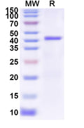 Recombinant Influenza A virus (H7N4) NA/Neuraminidase Protein, N-His