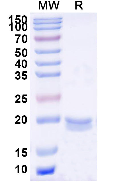 SDS-PAGE for Anti-HIV-1 rev/ART/TRS protein Nanobody (SAA1422)