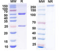 SDS-PAGE for Anti-FMDV Capsid protein VP1 Antibody (4C4).
