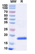 Recombinant Influenza A virus (H10N7) Matrix protein 1 Protein, N-His