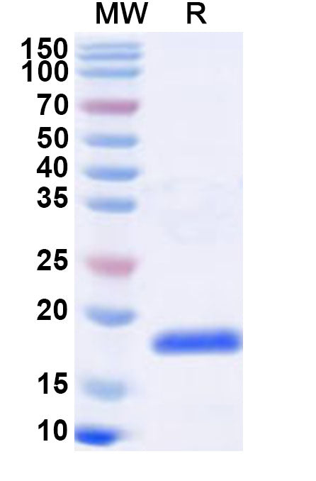 Recombinant Influenza A virus (H10N7) Matrix protein 1 Protein, N-His
