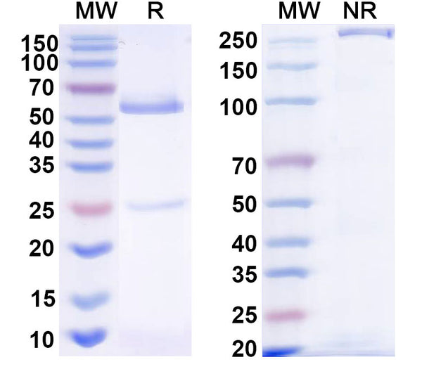 SDS-PAGE for Anti-HRSV-A F/Fusion glycoprotein F0 Antibody (Fab11)