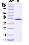 Recombinant Influenza A virus (H10N7) HA/Hemagglutinin Protein, N-His