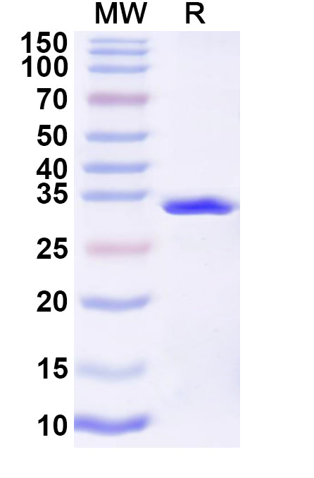 Recombinant Influenza A virus (H10N7) HA/Hemagglutinin Protein, N-His