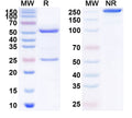 Anti-Influenza A virus HA/Hemagglutinin Reference Antibody (Firivumab) – Figure 1 of 1