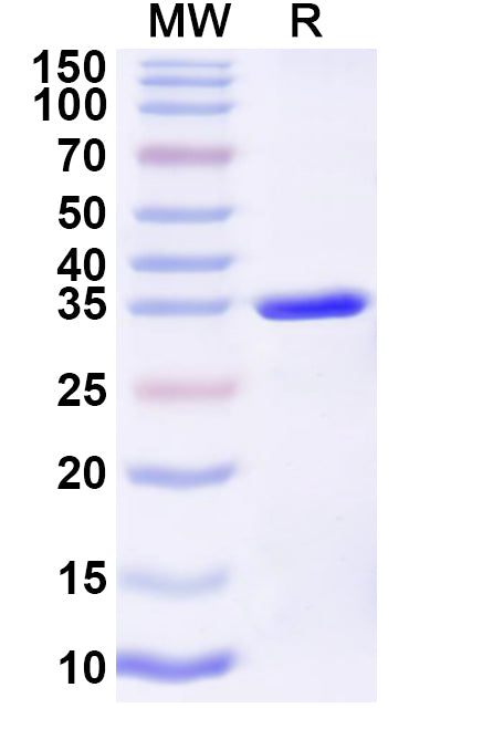 Recombinant Influenza A virus (H12N5) HA/Hemagglutinin Protein, N-His