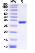 Recombinant Influenza A virus (H18N11) HA/Hemagglutinin Protein, N-His