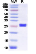 Recombinant Influenza A virus (H4N6) HA/Hemagglutinin Protein, N-His