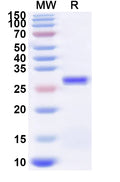 Recombinant Influenza A virus (H15N5) HA/Hemagglutinin Protein, N-His