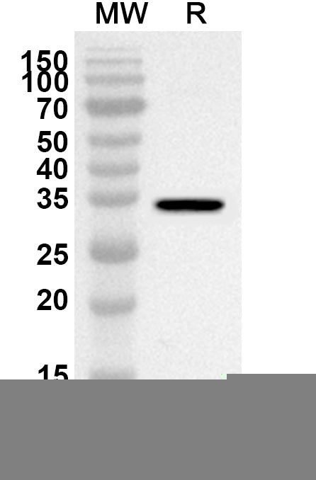 Western blot analysis was performed using anti-Influenza A virus (H8N4) HA/Hemagglutinin polyclonal antibody at 1ug/mL on recombinant Influenza A virus (H8N4) HA/Hemagglutinin (Catalog No. VK515152).