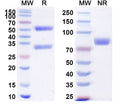 Recombinant bovine Influenza A virus (H5N1) HA/Hemagglutinin Protein, C-His