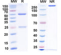 SDS-PAGE for Mouse Anti-Vaccinia virus/VACV A27 Antibody (8E3#).