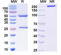 SDS-PAGE for Anti-Vaccinia virus/VACV A27L Antibody (186#)