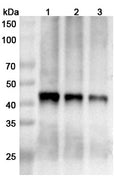 Western blot analysis was performed using anti-Nipah virus fusion protein polyclonal antibody at 1μg/ml on various samples.
Lane 1: recombinant Nipah virus/NiV F/Fusion glycoprotein F0 (Catalog No: VK521022), 70 ug
Lane 2: recombinant Nipah virus/NiV F/Fusion glycoprotein F0 (Catalog No: VK521022), 50 ug
Lane 3: recombinant Nipah virus/NiV F/Fusion glycoprotein F0 (Catalog No: VK521022), 30 ug